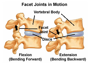 Facet_Joint_Injections_2