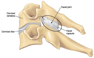facet-joint