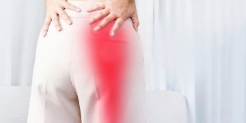 What Is Sciatica?